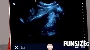 Ultra sound penetration sign in - dr wolf, austin
